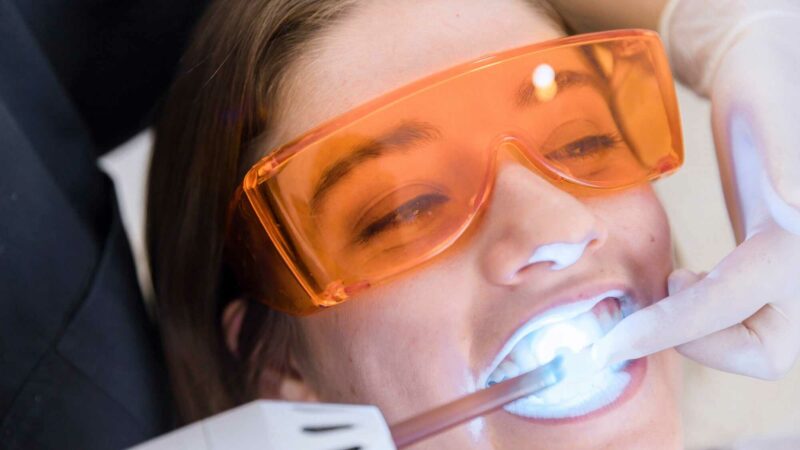 Diş Beyazlatma Nedir?